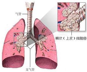 托达罗人口迁移模型_人口迁移(2)