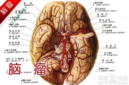 脑瘤手术需要多少钱