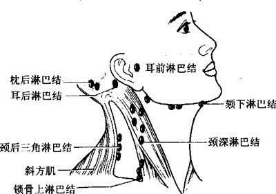 淋巴癌术后护理要点